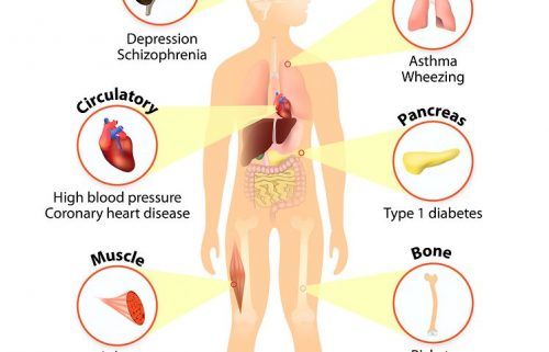 vitamin D deficiency