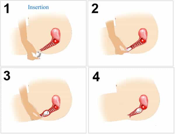 inserting a menstrual cup