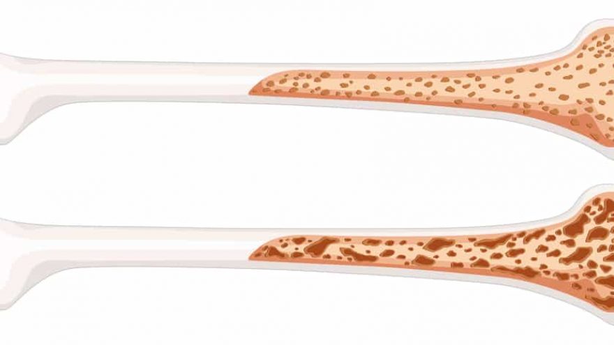 Exercises That Increase Bone Density healthy strong bones
